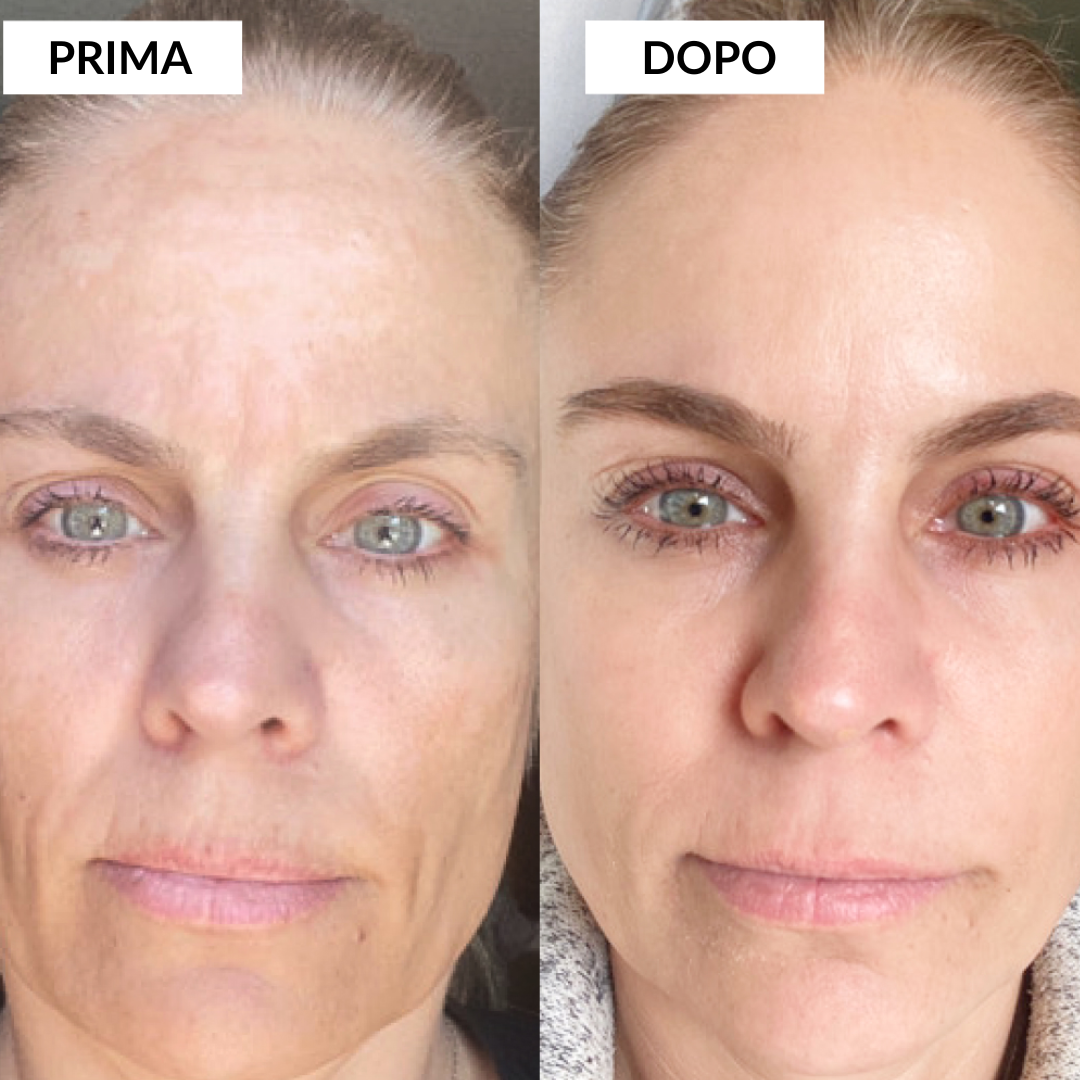 Moenia Routine